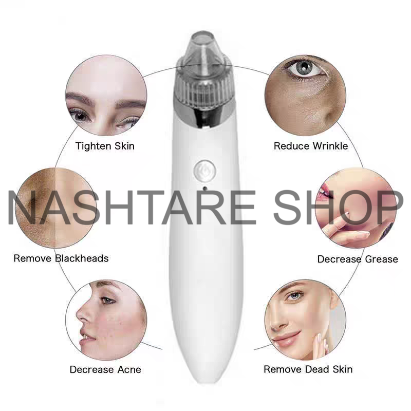 Electric Blackhead Remover | جهاز شفط و إزالة الرؤوس السوداء